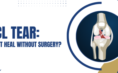 ACL Tear: Can It Heal Without Surgery?