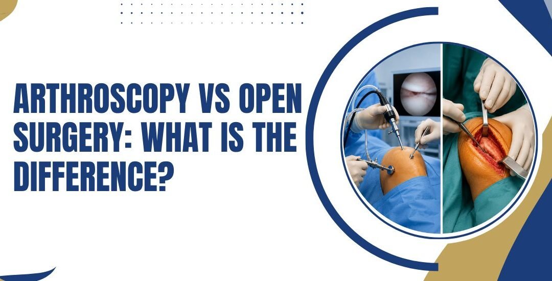 Arthroscopy vs Open Surgery What Is the Difference