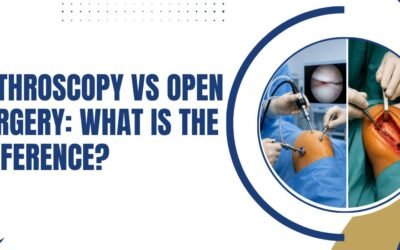 Arthroscopy vs Open Surgery:What Is the Difference?