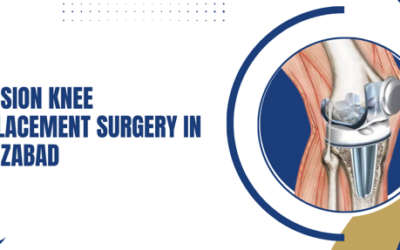 Revision Knee Replacement Surgery in Firozabad: When Is It Needed?