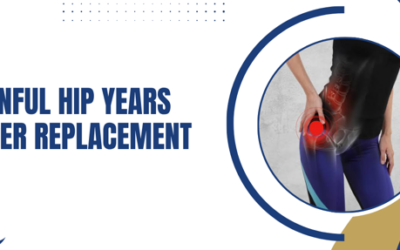 Painful Hip Years After Replacement: Could You Need Revision Surgery?