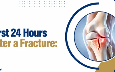 First 24 Hours After a Fracture: What to Do and When to See an Orthopedic Doctor