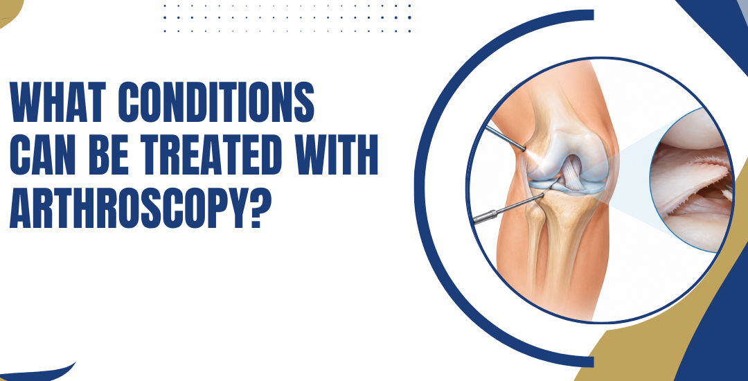 What Conditions Can Be Treated with Arthroscopy?