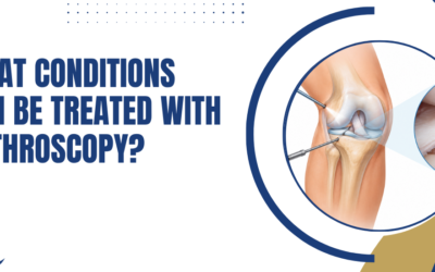 What Conditions Can Be Treated with Arthroscopy?
